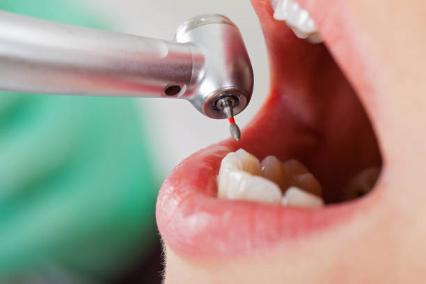 Best Urgent Dental Care for Toothaches in Bay City, MI